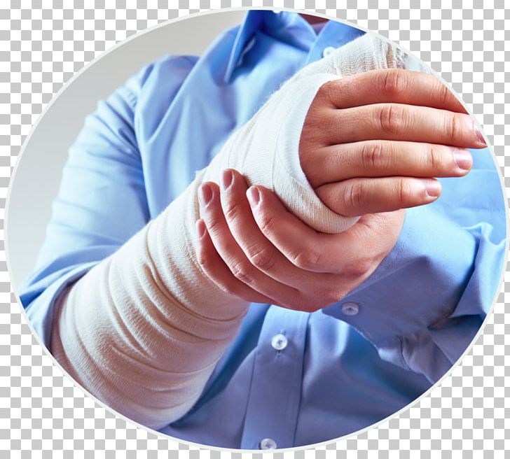Personal Injury Lawyer Law Firm PNG, Clipart, Accident, Finger, Hand, Injury, Joint Free PNG Download