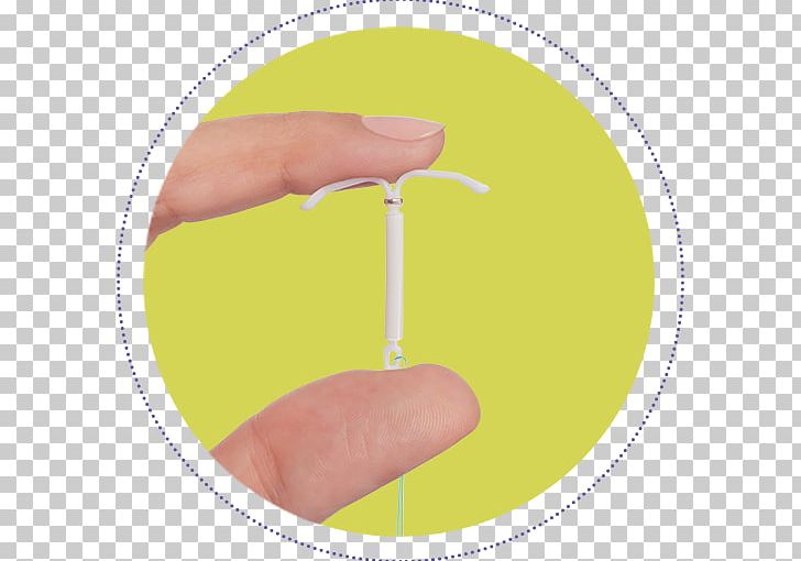 Intrauterine Device Progestin Iud Pregnancy Copper Iuds Birth Control