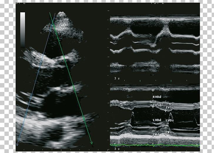 Ultrasonography Ultrasound Cardiology Ecógrafo Radiology PNG, Clipart, Advanced Technology, Anatomy, Black And White, Cardiology, Clinic Free PNG Download
