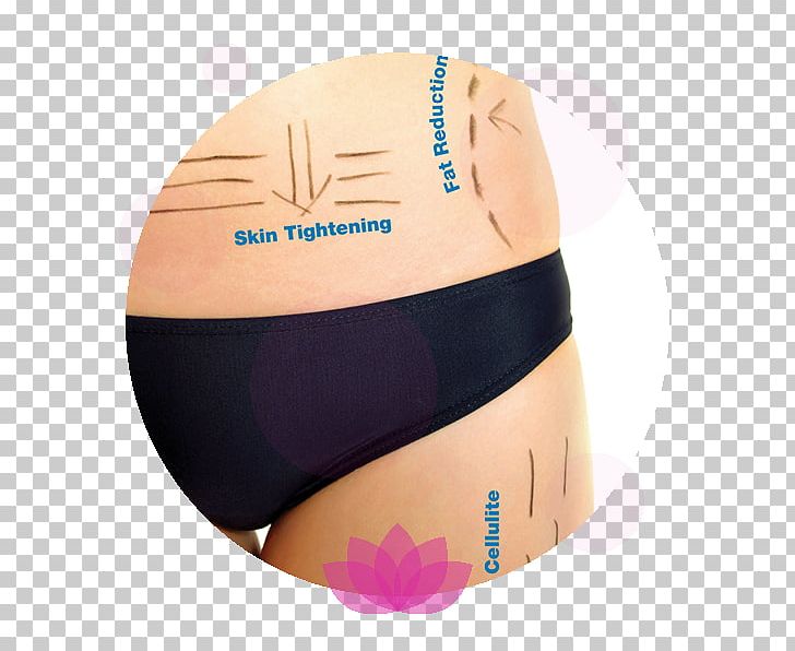 Radio Frequency Skin Tightening Human Body PNG, Clipart, Abdomen, Active Undergarment, Briefs, Cavitation, Electronics Free PNG Download