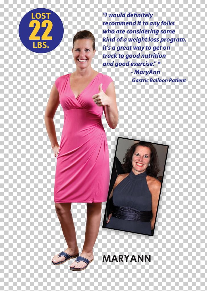 Bariatric Surgery Sleeve Gastrectomy Bariatrics Gastric Bypass Surgery PNG, Clipart, Advertising, Bariatrics, Bariatric Surgery, Cocktail, Cocktail Dress Free PNG Download