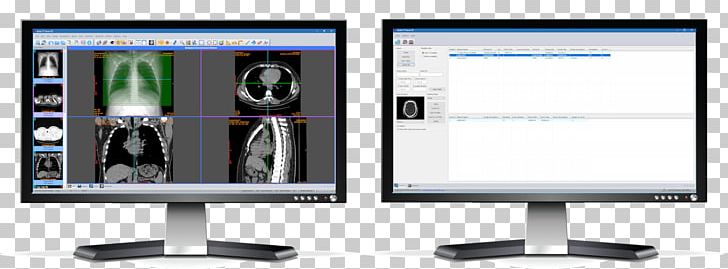 Computer Monitors Output Device Display Device Flat Panel Display Computer Monitor Accessory PNG, Clipart, Advertising, Computer Hardware, Computer Monitor, Computer Monitor Accessory, Computer Monitors Free PNG Download