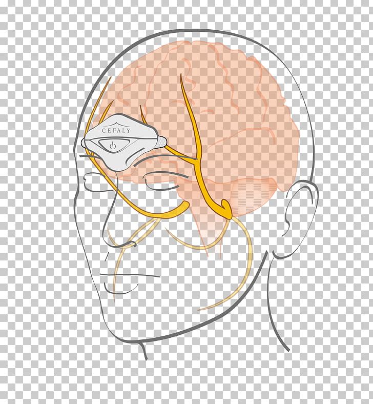Cefaly Trigeminal Nerve Neurostimulation Migraine Electrode PNG, Clipart, Cartoon, Electrode, Eye, Face, Fictional Character Free PNG Download