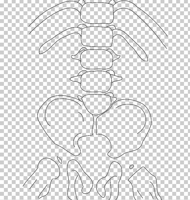Caudal Regression Syndrome Congenital Heart Defect Birth Defect Genetic Disorder PNG, Clipart, Angle, Area, Arm, Artwork, Atresia Free PNG Download