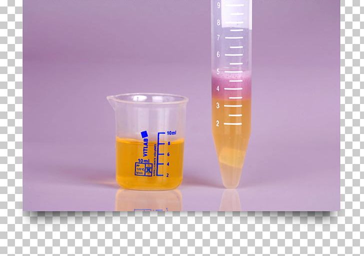 Clinical Urine Tests Drug Test Kidney Blood Test PNG, Clipart, Blood, Blood Test, Chemical Substance, Clinical Urine Tests, Drug Free PNG Download