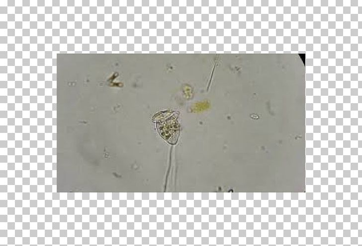 Vorticella Glass Microscope Slides Science Plastic PNG, Clipart, Chlamydomonas, Glass, Google Slides, Microscope Slides, Mite Free PNG Download
