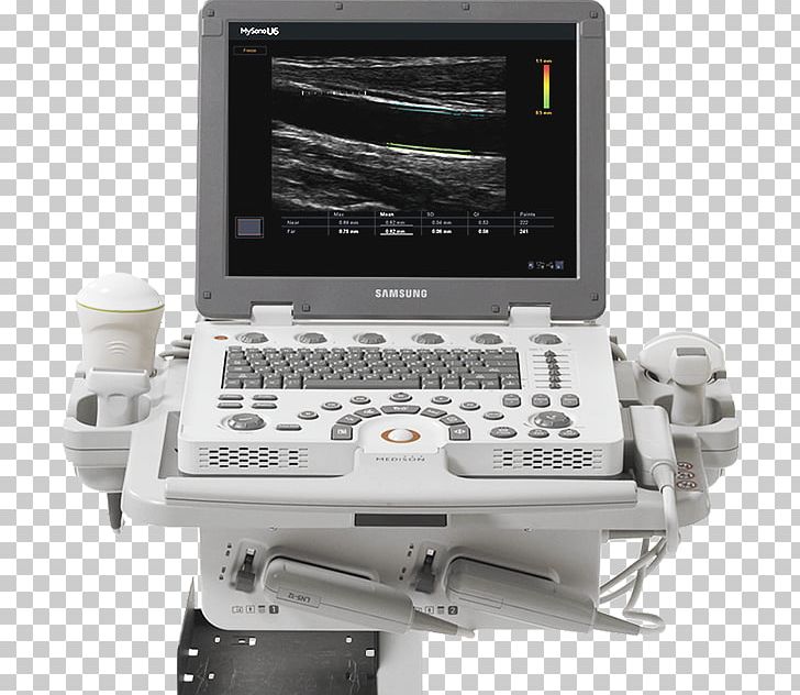 Medical Equipment Ultrasound Medicine Ultrasonography Ecógrafo PNG, Clipart, Artery, Computer Monitor Accessory, Electronics, Imt, Machine Free PNG Download