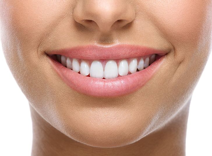 Tooth Whitening Cosmetic Dentistry Smile PNG, Clipart, Beauty, Cheek, Chin, Clear Aligners, Closeup Free PNG Download