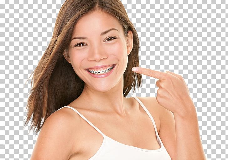 Clear Aligners Dental Braces Cosmetic Dentistry PNG, Clipart, Arm, Beauty, Bridge, Cheek, Clear Aligners Free PNG Download