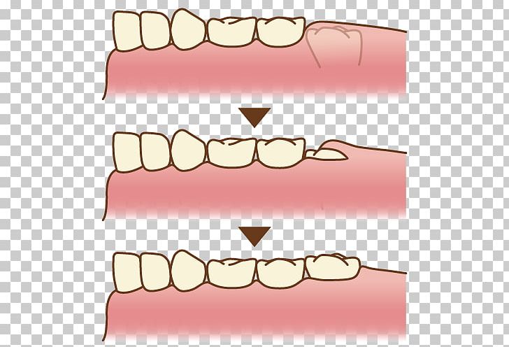 Tooth Molar Dentistry PNG, Clipart, Area, Dentistry, Dentures, Eyelash, Human Body Free PNG Download