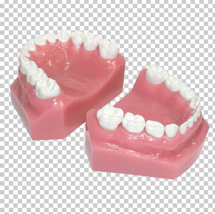 Human Tooth Pediatric Crowns Posterior Teeth PNG, Clipart, Crown, Crowns, Dental Restoration, Dentistry, Health Free PNG Download
