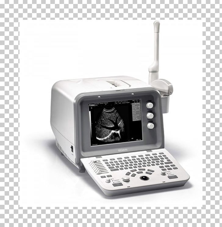 3D Ultrasound Ultrasonography Medical Equipment Voluson 730 PNG, Clipart, 3d Ultrasound, Compute, Dus, Electronics, Electronics Accessory Free PNG Download