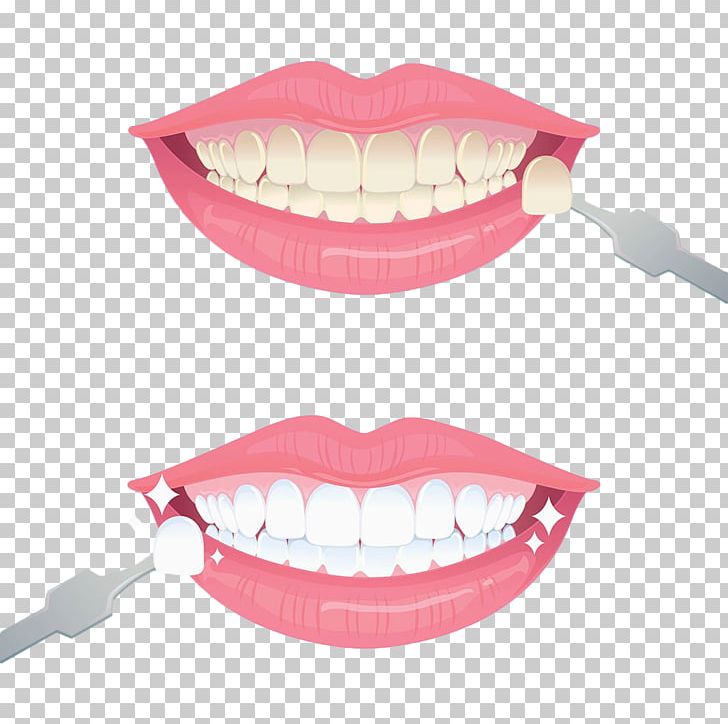 Tooth Whitening Euclidean PNG, Clipart, Dental Prosthesis, Dentistry, Encapsulated Postscript, Face, Gratis Free PNG Download