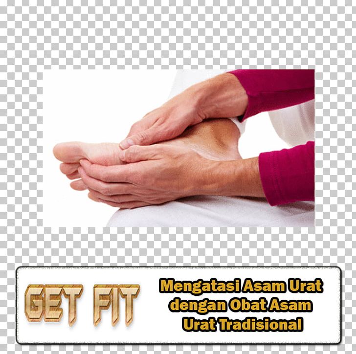 Sprain Surgery Podiatry Arthritis Foot PNG, Clipart, Arm, Arteriosclerosis, Arthritis, Diet, Disease Free PNG Download