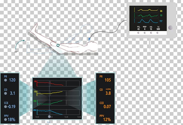 Vytech S.r.l. Hemodynamics Vygon Italia Srl MostCare Social Media PNG, Clipart, Algorithm, Analysis, Cardiac Output, Cardiology, Electronics Free PNG Download