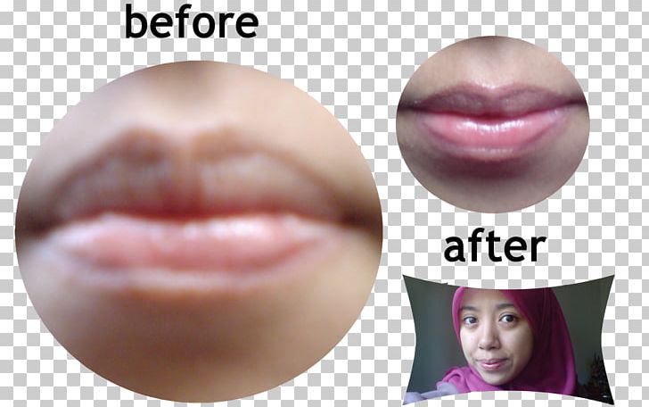 Lip Gloss Lipstick Close-up Eyelash PNG, Clipart, Beauty, Beautym, Cheek, Chin, Closeup Free PNG Download