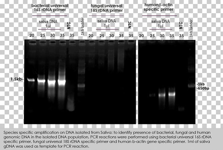 Polyacrylamide Gel Electrophoresis Polymerase Chain Reaction Denaturation PNG, Clipart, Agarose Gel Electrophoresis, Amines Biotech Private Limited, Angle, Automotive Tire, Black And White Free PNG Download