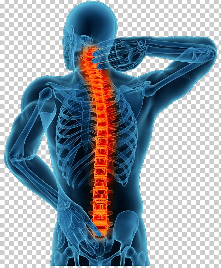 Back Pain Pain Management Therapy Spinal Disc Herniation Degenerative Disc Disease PNG, Clipart, Back Pain, Chronic Pain, Disease, Electric Blue, Food Drinks Free PNG Download