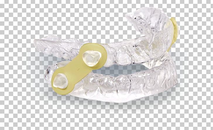 Mandibular Advancement Splint Obstructive Sleep Apnea Snoring PNG, Clipart, Apnea, Crystal, Dentist, Dentistry, Fashion Accessory Free PNG Download