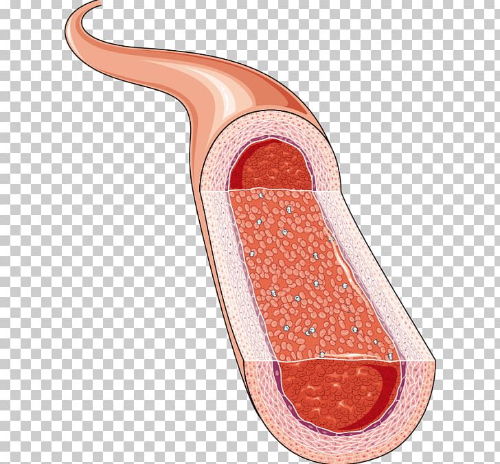 Artery Cardiology Phlebology Arteriole Medicine PNG, Clipart, Art, Arteriole, Arteriosclerosis, Artery, Cardiology Free PNG Download