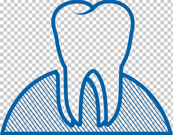 Dental Surgery Dental Extraction Wisdom Tooth Dental Implant PNG, Clipart, Area, Arizona, Artwork, Black And White, Blue Free PNG Download