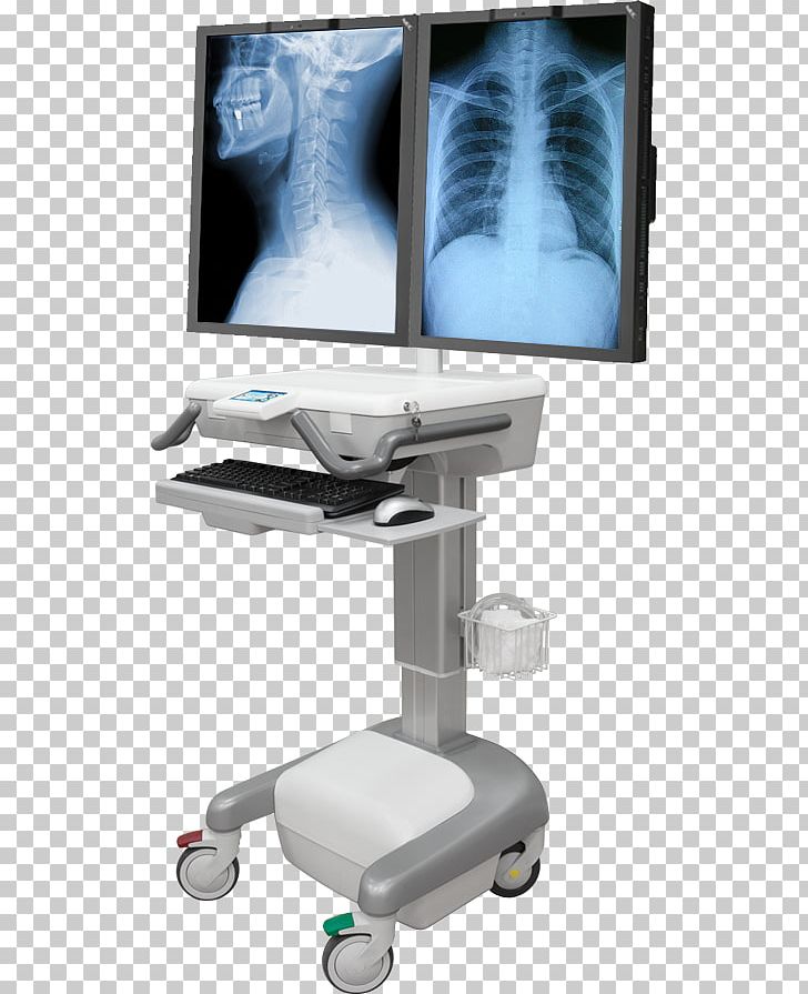 Medical Equipment Radiology Health Care Medicine Medical Device PNG, Clipart, Computer Monitor Accessory, Health, Health Technology, Hospital, Hospital Bed Free PNG Download