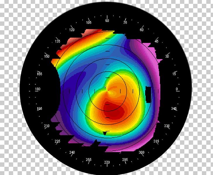 Corneal Topography Keratoconus Eye PNG, Clipart, Astigmatism, Cataract, Circle, Cornea, Corneal Topography Free PNG Download