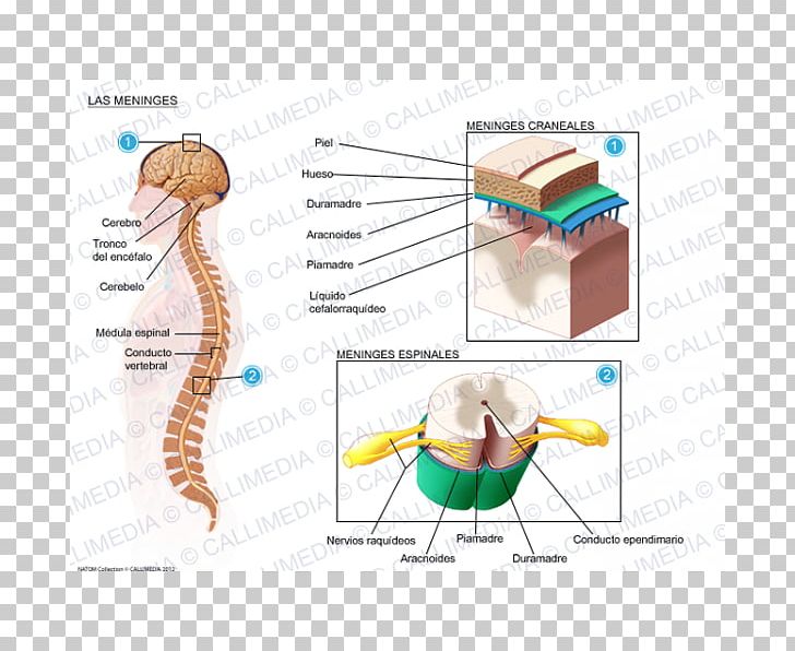 Meningitis Meninges Spinal Cord Cerebrospinal Fluid Virus PNG, Clipart, Abdomen, Anatomy, Angle, Area, Arm Free PNG Download