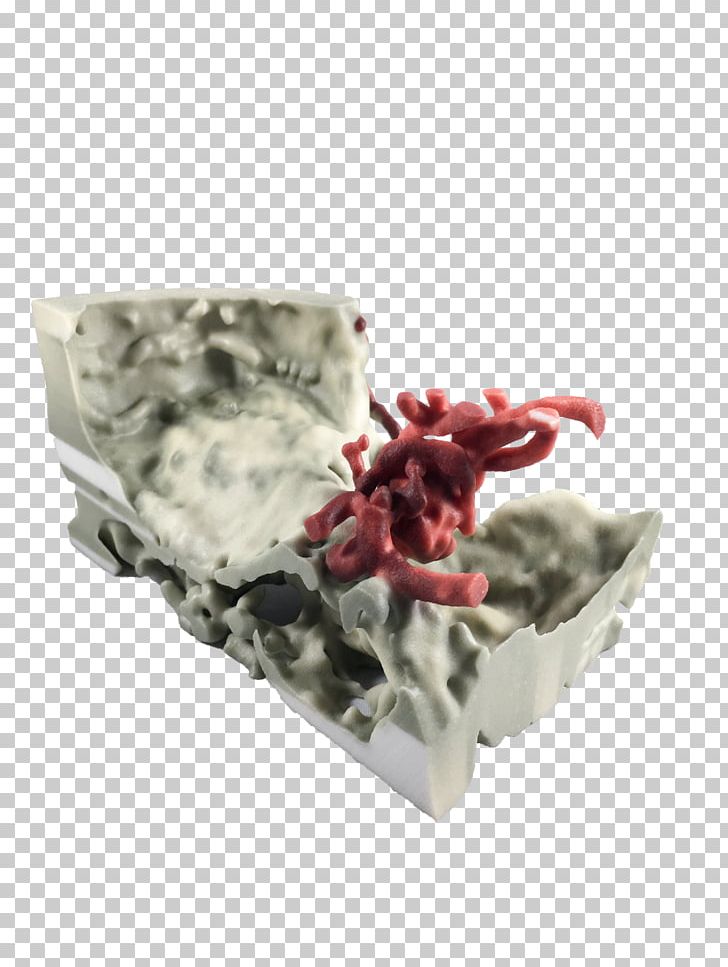 3D Printing 3D Computer Graphics Neuroradiology Stanford Radiology 3D And Quantitative Imaging Lab PNG, Clipart, 3d Computer Graphics, 3d Printing, Brain, Color, Conjunction Free PNG Download