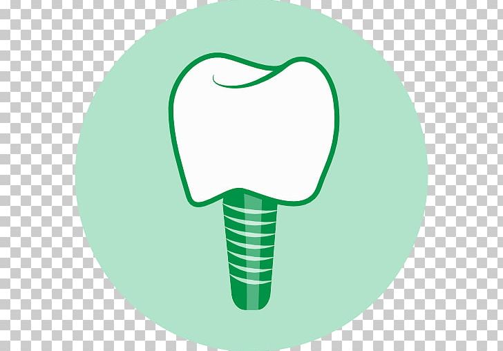 Dental Implant Dentistry Human Tooth Dentures PNG, Clipart, Clinic, Dental Hygienist, Dental Implant, Dental Radiography, Dentistry Free PNG Download