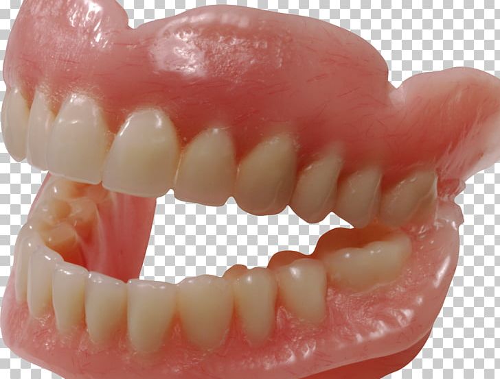 Human Tooth Dentures PNG, Clipart, Canine Tooth, Dentist, Dentistry, Dentures, Health Beauty Free PNG Download