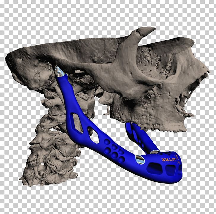 Applications Of 3D Printing Jaw Mandible PNG, Clipart, 3d Computer Graphics, 3d Printing, Applications Of 3d Printing, Bioprinting, Bone Free PNG Download