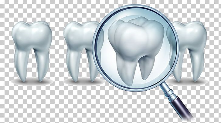 Cosmetic Dentistry Dental Implant Human Tooth PNG, Clipart, Allon4, Cosmetic Dentistry, Dental Extraction, Dental Floss, Dental Implant Free PNG Download