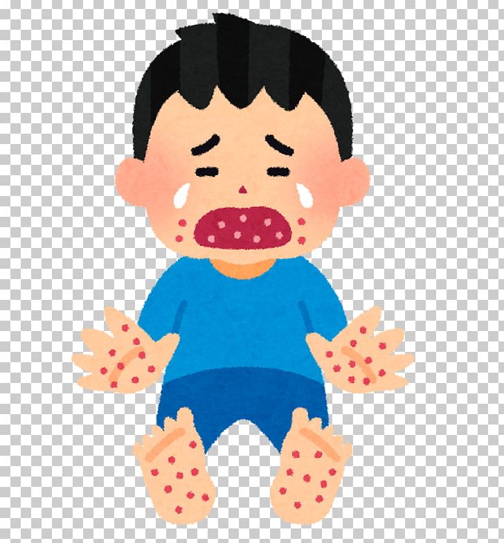 Hand PNG, Clipart, Adenoviral Keratoconjunctivitis, Baby Toys, Blister, Boy, Cheek Free PNG Download