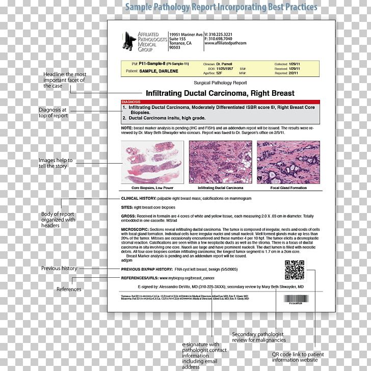 Surgical Pathology Surgery Digital Pathology Biopsy PNG, Clipart, Acute Abdomen, Anatomical Pathology, Area, Biopsy, Cancer Free PNG Download