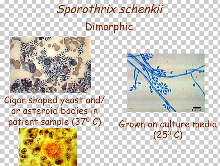 Sporothrix Schenckii Organism PNG, Clipart, Organism, Text, Usmle Step 3 Free PNG Download