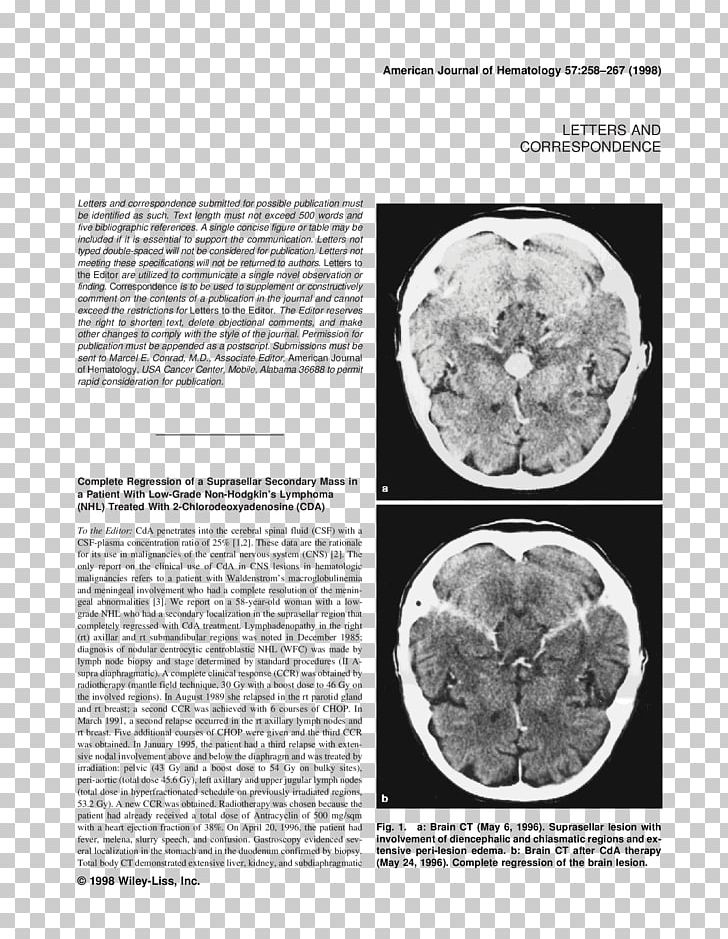 Brain Organism White Font PNG, Clipart, Black And White, Brain, Cys, Diagnosis, Jaw Free PNG Download