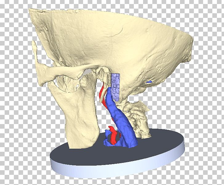Petrous Part Of The Temporal Bone Anatomy Carotid Canal Middle Ear PNG, Clipart, Anatomy, Bone, Carotid Canal, Common Carotid Artery, Dural Venous Sinuses Free PNG Download