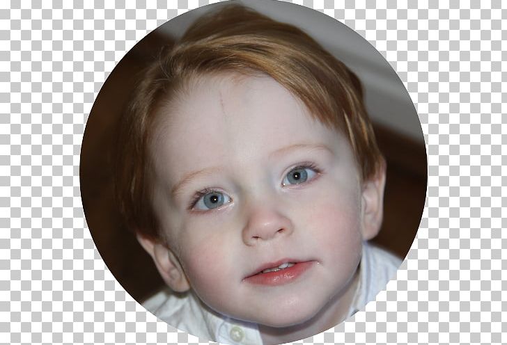 Cheek Chin Portrait Forehead Mouth PNG, Clipart, Brown Hair, Cheek, Child, Child Model, Chin Free PNG Download