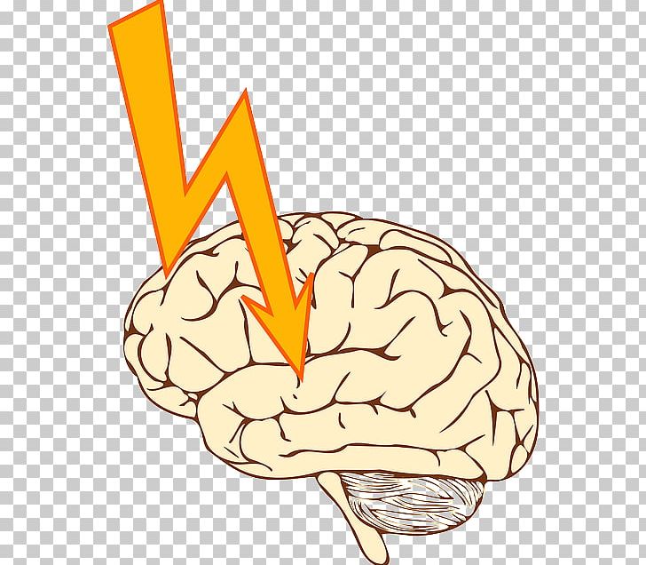 Stroke Apoplexy PNG, Clipart, Apoplexy, Beak, Brain, Clip Art, Download Free PNG Download