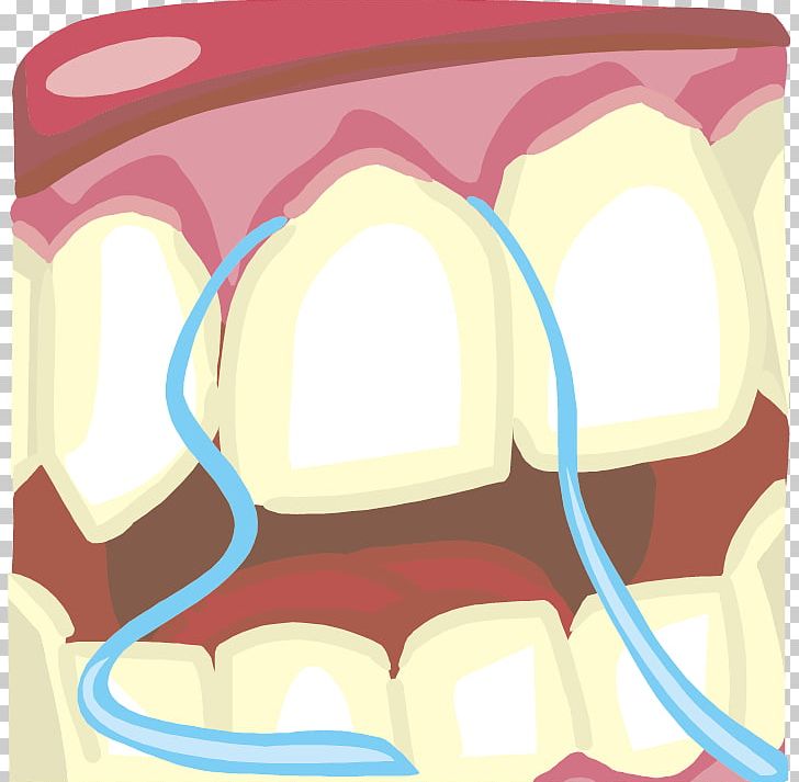 Tooth Pathology Dental Floss Tooth Brushing PNG, Clipart, Cartoon, Dentistry, Happy Birthday Vector Images, Health Vector, Illustrations Free PNG Download