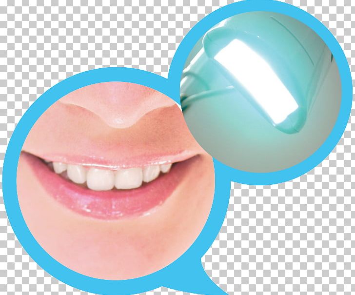 Tooth Dentistry Thailand PNG, Clipart, Cheek, Chin, Confidence, Customer, Dentist Free PNG Download