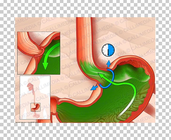 Esophagus Upper Esophageal Sphincter Cardia Sfintere Esofageo Inferiore PNG, Clipart,  Free PNG Download