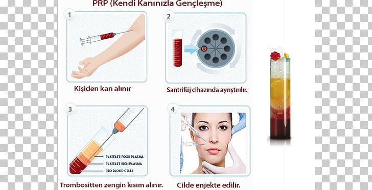 Platelet-rich Plasma Therapy Blood Plasma PNG, Clipart, Anticoagulant, Blood, Blood Plasma, Brand, Dermatology Free PNG Download