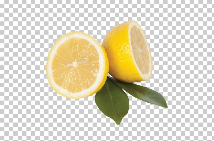 Lemon Fruit Vitamin C Citrxf3n PNG, Clipart, Citric Acid, Citron, Citrus, Citrxf3n, Download Free PNG Download