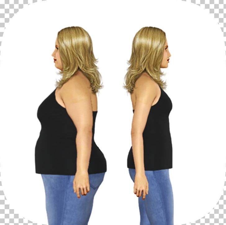 Weight Loss Coaching The Hypnotic Gastric Band Exercise Diet PNG, Clipart, Adjustable Gastric Band, App Store, Arm, Body Mass Index, Calorie Free PNG Download