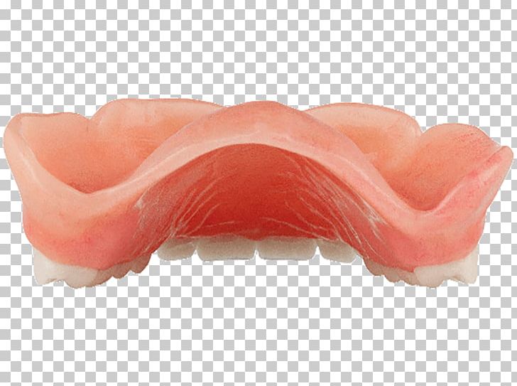 Mouth Dentures PNG, Clipart, Denture, Dentures, Jaw, Mouth, Others Free PNG Download