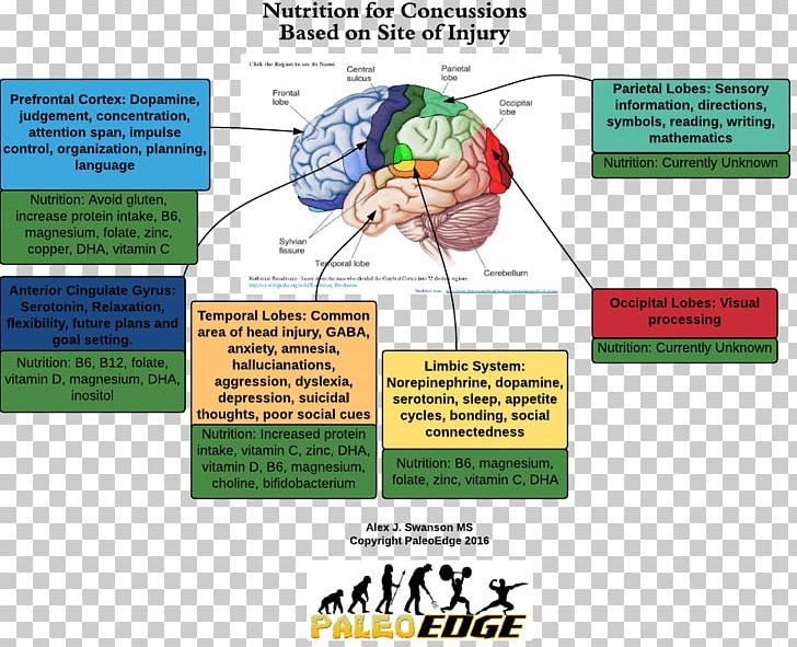 Concussion Traumatic Brain Injury Dietary Supplement Therapy PNG, Clipart, Area, Brain, Brain Injury, Concussion, Diagram Free PNG Download