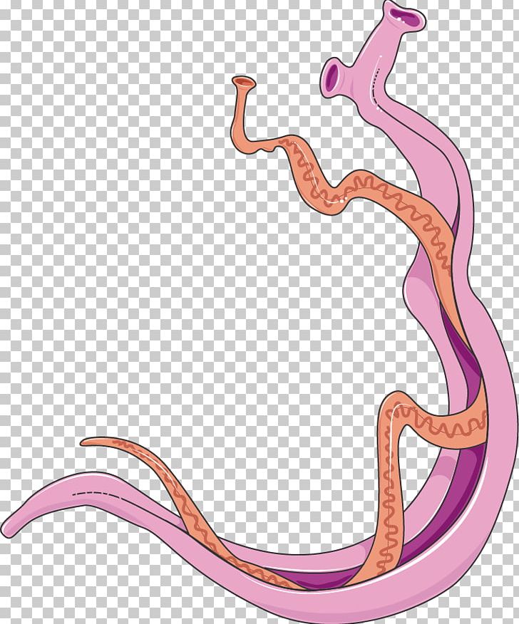 schistosoma mansoni and cancer