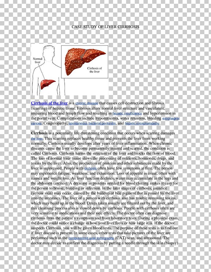 Medical Illustration Photography PNG, Clipart, Art, Biomedical Sciences, Case, Case Study, Cirrhosis Free PNG Download